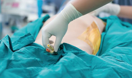 Urology Products